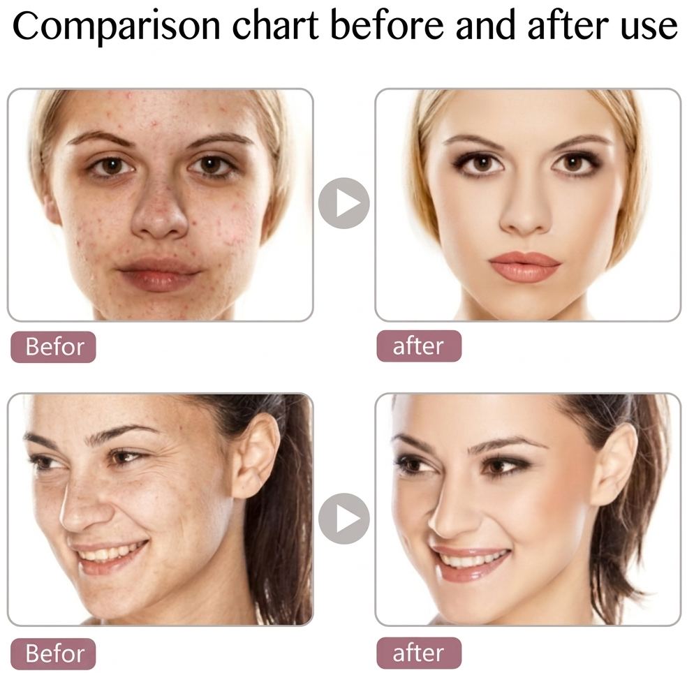 LED Photon Light Therapy Face Mask