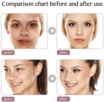 LED Photon Light Therapy Face Mask
